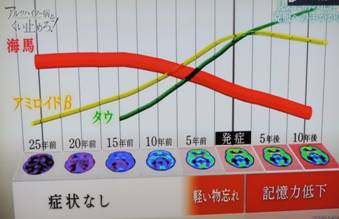2014.1.23 ?A???c?n?C?}?[?a 001.JPG